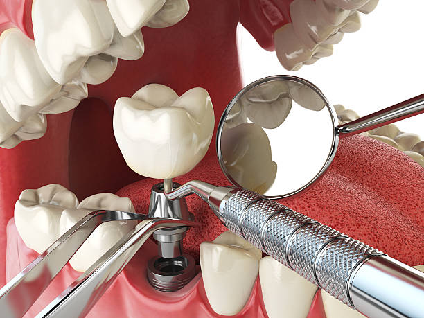 Best Knocked-Out Tooth Emergency  in Commerce, TX